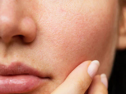 The Truth About Pores: Can You Really Shrink Them?