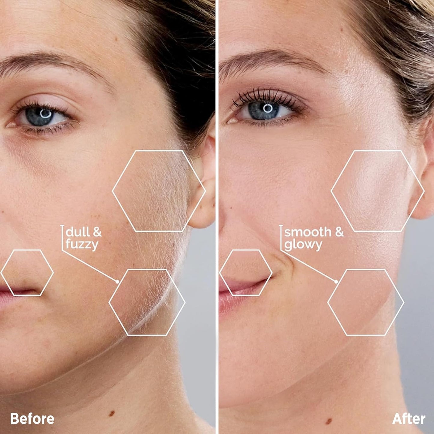 Epilator Face Hair Removal